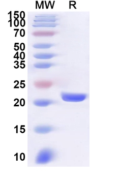 Recombinant Human MORF4L2 Protein, N-His