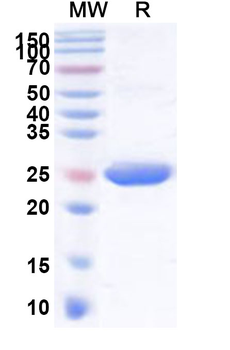Recombinant Human UBE2R2 Protein, N-His