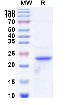 Recombinant Human LAIR1 Protein, N-His