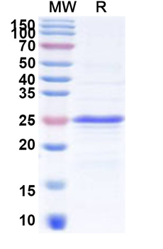 Recombinant Human CDSN Protein, N-His-KSI