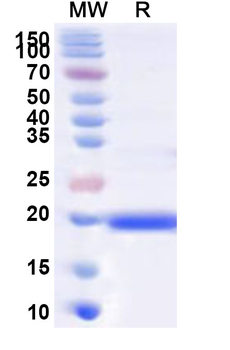 Recombinant Human IL1F10 Protein, N-His