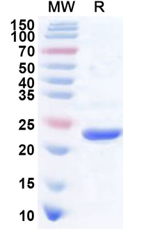 Recombinant Human CTF1 Protein, N-His