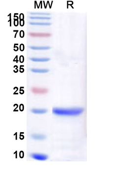 Recombinant Human ZBED1 Protein, N-His