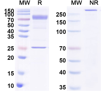 CHIKV Spike glycoprotein E2 Antibody