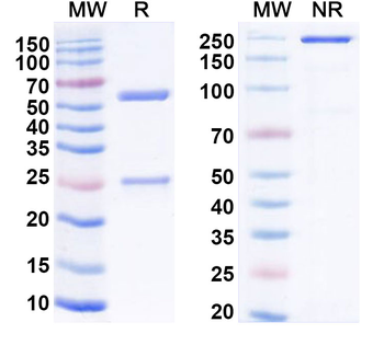 JUNV Glycoprotein GPC Antibody