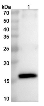 HPV18 E7/Protein E7 Polyclonal Antibody