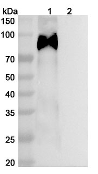 HCMV/HHV5 gB/Envelope glycoprotein B Antibody