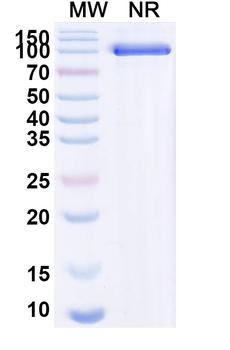 PEDV Spike glycoprotein (RBD) Antibody