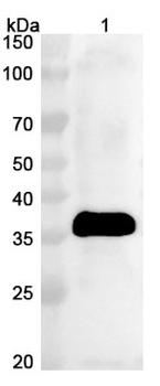 HPV58 E7 Polyclonal Antibody
