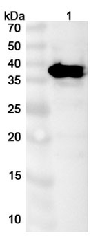 HAdV-5 E1B-55K/E1B-495R Polyclonal Antibody