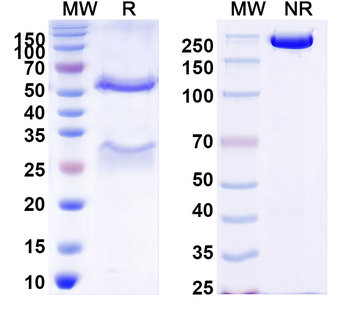 Langya virus/LayV G/Glycoprotein Antibody