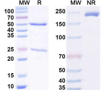HPV31 E7/Protein E7 Antibody