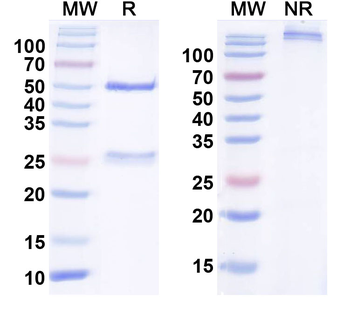 Human CD56/NCAM1 Monoclonal Antibody