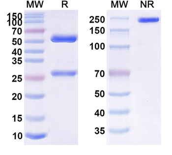 Human ANXA1 Monoclonal Antibody