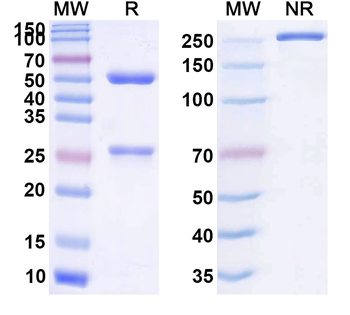 Human ANXA1 Monoclonal Antibody