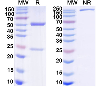 Human CXCL16/SR-PSOX Monoclonal Antibody