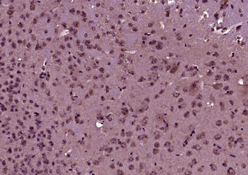 GDF10 Rabbit Polyclonal Antibody