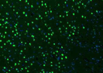 MYBL2 Rabbit Polyclonal Antibody