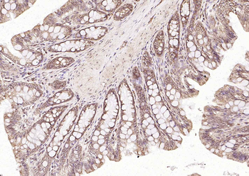 Frizzled 5 Rabbit Polyclonal Antibody