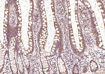 Frizzled 5 Rabbit Polyclonal Antibody