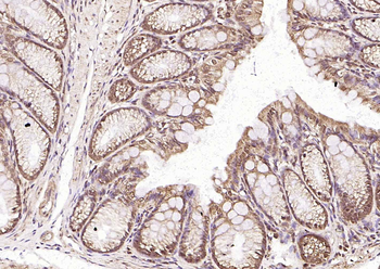 Frizzled 5 Rabbit Polyclonal Antibody