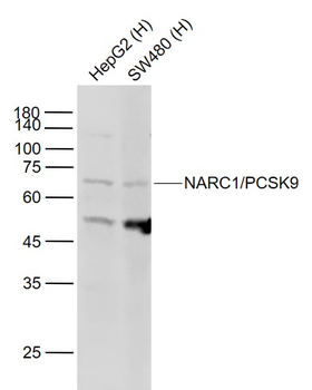 NARC1/PCSK9 Rabbit Polyclonal Antibody