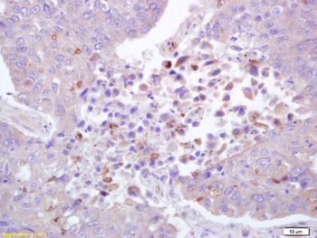 Phospho-ROCK1 (Thr455+Ser456) Rabbit Polyclonal Antibody