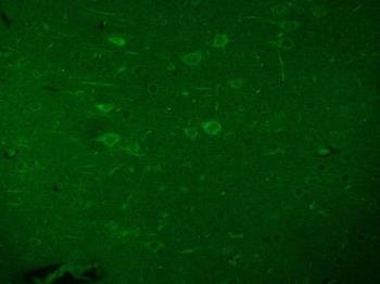 Beta galactosidase Rabbit Polyclonal Antibody