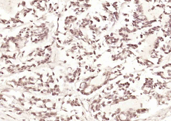 DAP1 Rabbit Polyclonal Antibody
