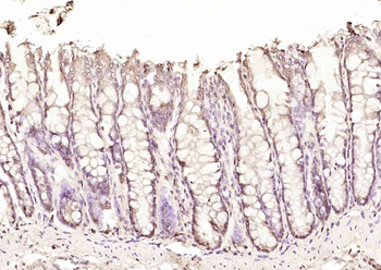 DAP1 Rabbit Polyclonal Antibody