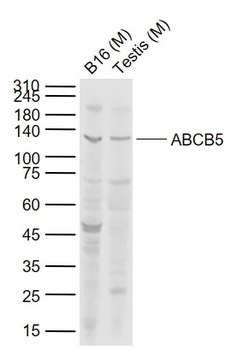 ABCB5 Rabbit Polyclonal Antibody