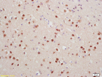 Phospho-Histone H1.4 (Thr18) Rabbit Polyclonal Antibody