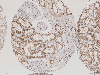AQP2 Rabbit Polyclonal Antibody