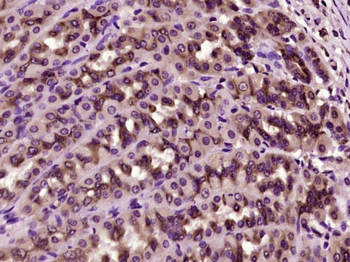 HPGD Rabbit Polyclonal Antibody