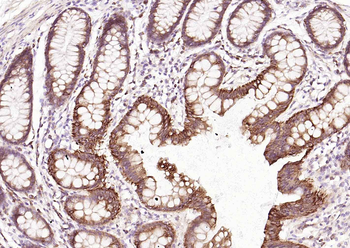 TSPAN8 Rabbit Polyclonal Antibody