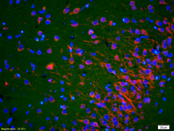 ACTH (18-39) Rabbit Polyclonal Antibody