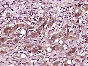 ASC/TMS1 Rabbit Polyclonal Antibody