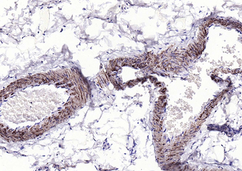 Alpha smooth muscle Actin Rabbit Polyclonal Antibody