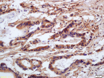 Myosin light chain (phospho S20) Rabbit Polyclonal Antibody