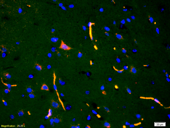 ADAMTS7 (NT) Rabbit Polyclonal Antibody