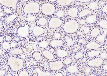 UBE2V1 Rabbit Polyclonal Antibody