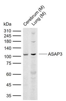 ASAP3 Rabbit Polyclonal Antibody
