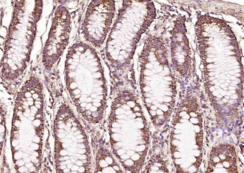 RBM3 Rabbit Polyclonal Antibody