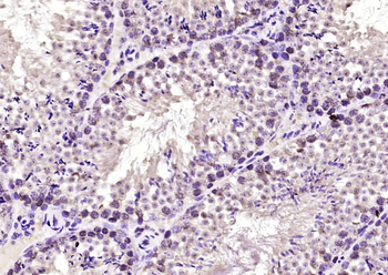 THRA1+2 Rabbit Polyclonal Antibody