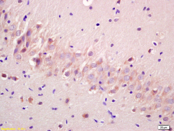 Phospho-GSK3A (Ser21) Rabbit Polyclonal Antibody