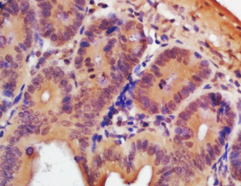 TSPYL5 Rabbit Polyclonal Antibody