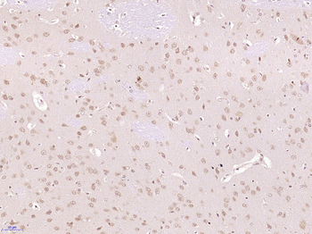 FRS2 Rabbit Polyclonal Antibody
