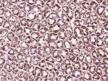 MACC1 Rabbit Polyclonal Antibody