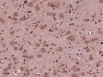 ACAN Rabbit Polyclonal Antibody