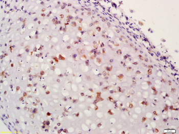 ACAN Rabbit Polyclonal Antibody